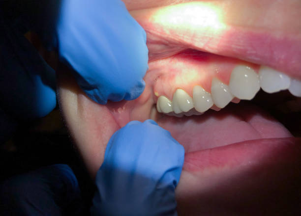 Best Walk-In Emergency Dental Services in Mountville, PA